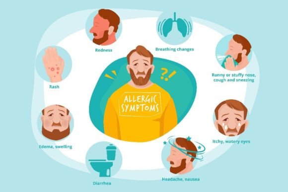 Understanding Allergic Symptoms in Infected Humans